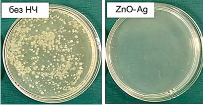 Tomsk State University and State Islamic University of Raden Intan Lampung will create and test new antimicrobial materials